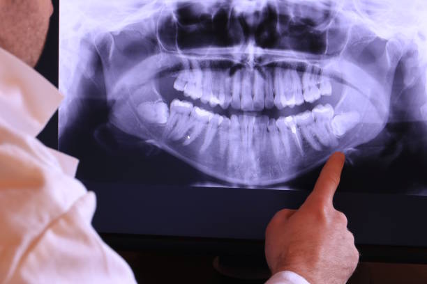 Best Emergency Dentist for Knocked-Out Tooth in Rawls Springs, MS